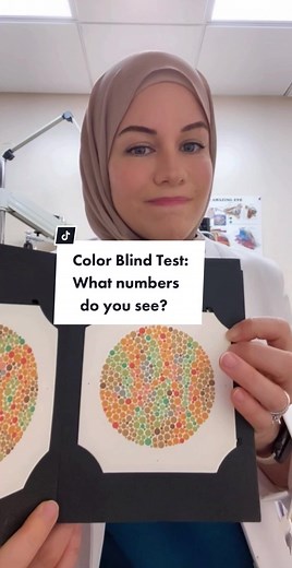#colorblindness is more common than you think and affects an estimated 8% of the population (most common in males) #eyehealth #eyedoctor #colorblind #fyp #fypシ #viral