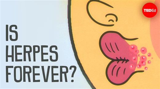Today, more than half the population is infected with herpes simplex virus. So, what causes herpes? And how can we treat it? | TED-Ed