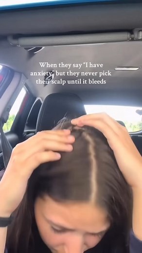 2.9K views |  You won't believe what came out of this one... #pimplepop #satisfying | Blackheads Popping | Facebook