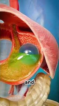 Inside the Stomach Balloon Weight-Loss Procedure (3D Animation) #gastricballoon