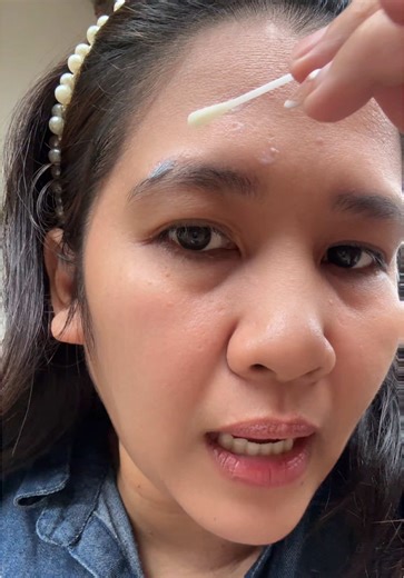 Effective Salicylic Acid Blemish Control Lotion for Acne