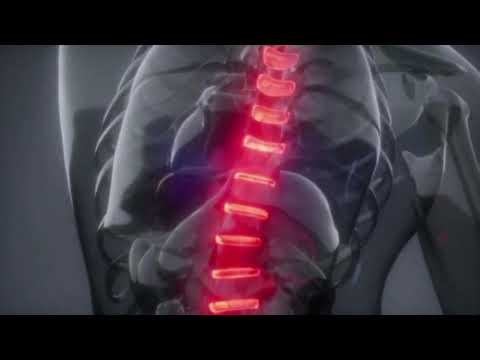 The Spinal Tapper SAPIEN MED