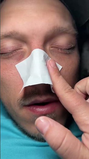 Satisfying Blackhead Removal: A Close-Up Nose Strip Transformation#blackheadremoval