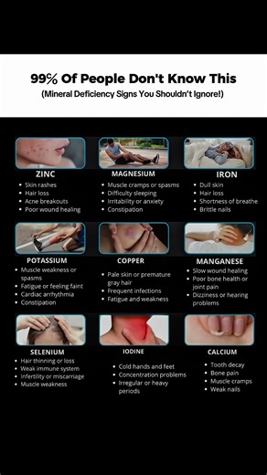Signs You Have a Mineral Deficiency 😳 | Must Watch!#MineralDeficiency #HealthAwareness #WellnessTips