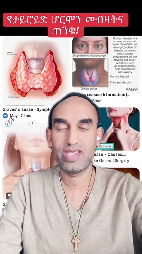 Understanding Hyperthyroidism and Its Symptoms