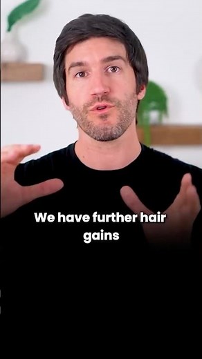 Why Some Men Switch To Dutasteride For Hair Loss
