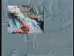 Allotransplantation hépatique chez le porc | Canal U