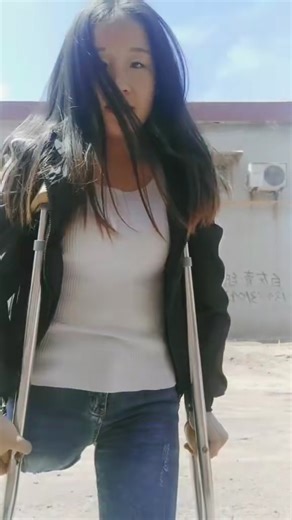 Naomi SAK amputee beauty #amputee #asian #disab.. | Kilponga12