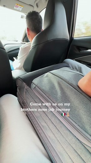 Mexico Nose Job Journey: Before and After