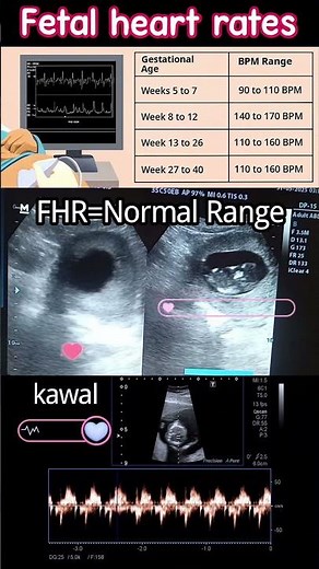 💓 Normal Fetal Heart Rate by Weeks | Ultrasound Explained #ultrasound #baby
