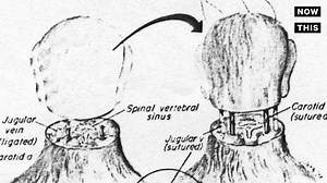 994K views · 3K reactions | This doctor might pull off the world’s first head transplant | NowThis Earth | Facebook