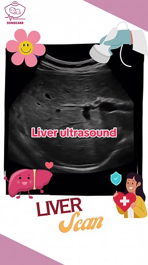 SonoCare Ultrasound Scan on TikTok
