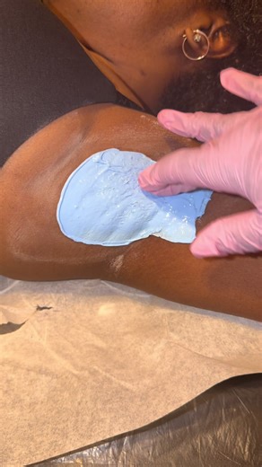 😭😭😭 I’m sorry . . . #waxspecialist #chicagoesthetician #fyp #ingrownhair #waxing