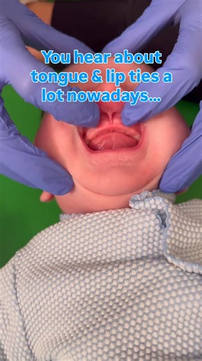 Holly Grabert*Feeding Specialist*Online Virtual Coaching | ✨ Here 👇 comment “ME” to get direct access to our NEW Oral Restriction, Tongue & Lip Tie Survival Guide — created to help parents... | Instagram