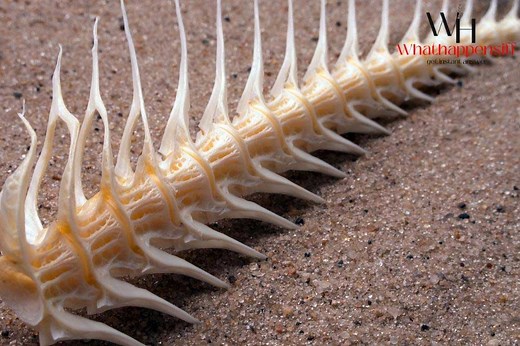 What Happens If You Swallow a Bone? (How To Face And Handle)