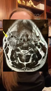 214K views · 1.6K reactions | Case study 115 - Neck mass /...