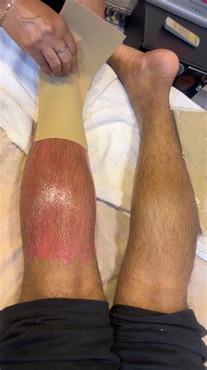 102K views · 406 reactions | How to do leg waxing on thick hard hair #wax #waxing #legwax | Monalisa Beauty Parlour | Facebook