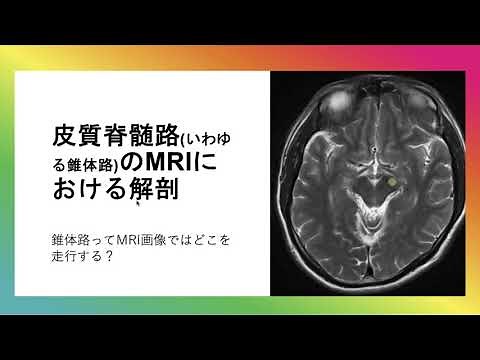 皮質脊髄路（錐体路）のMRI画像における解剖（脳梗塞などで重要）