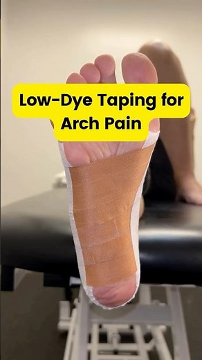 Low-Dye Taping for Arch Pain