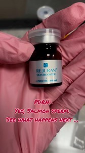The injectable that repairs your skin from the inside out 👇It’s called PDRN and it’s not just hype.💉 Made from salmon DNA (yep, really), this regenerative powerhouse:✔️ Stimulates collagen elastin✔️ Repairs damaged skin barrier✔️ Reduces inflammation redness✔️ Boosts hydration glow✔️ Speeds up healing post-procedureIf your skin feels dull, inflamed, or stuck in repair mode…this might be your secret weapon.Not Botox. Not filler.Just pure cellular regeneration shoot Lauren a Dm to get booked tod