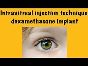 Intravitreal injection technique: Ozurdex