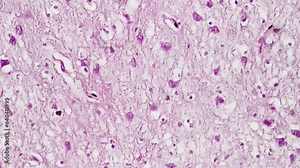 Sensory cortex in section of human magnified in 400 times under microscope on bright field at biological laboratory. Studying brain structure using professional equipment during lessons at university.