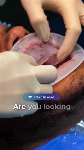 #tandlæge #digitaldentistry #smiledesign #ipsemax #veneers #minimalinvasiv #æstetisktandpleje #trioclear360 | Elysee Dental Danmark