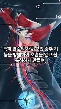 숨 쉬기 힘들고 온몸이 무겁다면? 뇌로 가는 관문 '후두하근'을 반드시 풀어야 하는 의학적 이유
