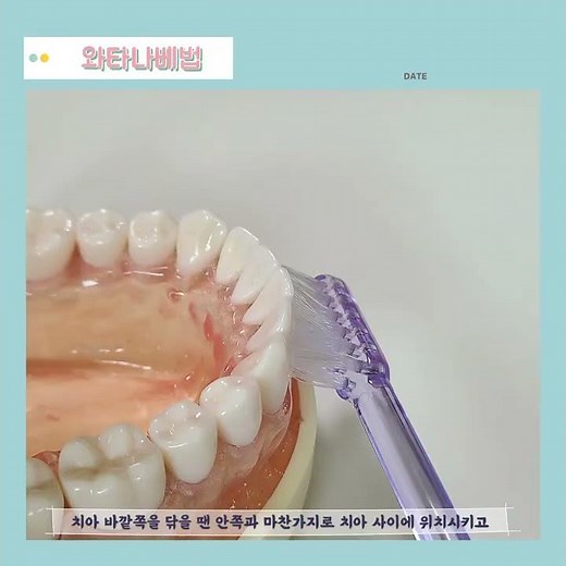 [구강 건강 서포터즈 4기 이투스] 와타나베법🪥 에 대해 알아봅시다 ❗️