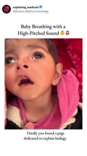 Baby Breathing with a High-Pitched Sound 👶