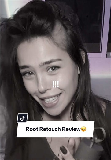 Best Root Retouch Methods for Alopecia and Hair Loss