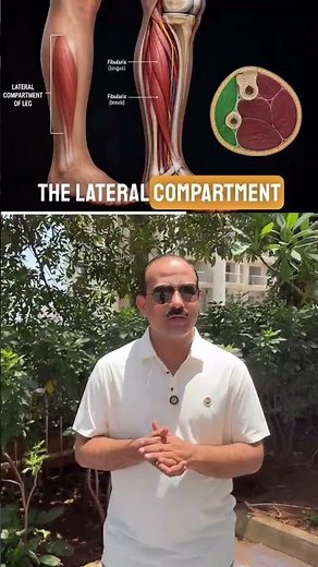 High Stepping Gait = Foot Drop 🚶‍♂️Common peroneal nerve injury explained in seconds!