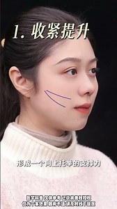 口周状态最小成本领跑同龄人！2条韧带实现口周紧致提升口角囊袋口周年轻化口周北京注射勾涛复合支点提升