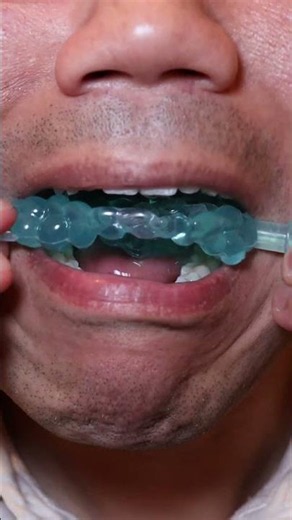 ASMR | Just eat the Jelly and not the plastic LOL #DoctorTristanPeh #Jelly #ASMR