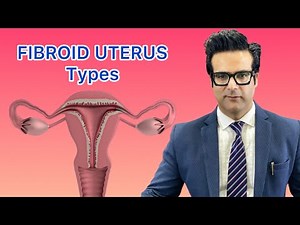 Types of fibroid uterus.
