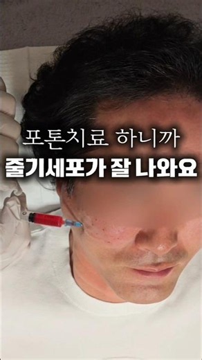 Get Quality Stem Cells Through Blood Purification and Photon Therapy