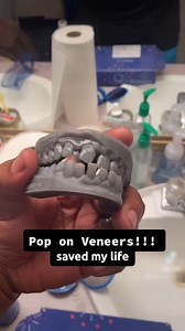 This transformation says it all!🤯 Pop On Veneers makes it easy to get a smile you feel good about in seconds, without breaking the bank.💙 Ready to get your smile back?👉 https://poponveneers.com/pages/am-i-a-candidate ⭐⭐⭐⭐⭐ 27,000 raving reviews 💵 Payment options as low as $29 1️⃣ Impression Molds Kit Sent to Your 🏠 2️⃣ Send back your teeth molds to POP ON in NYC🗽 3️⃣ Smile Delivered! 🎉 It's So Easy! ➕ Free Gifts 🎁 👏 Painless w/o dentist 🙅‍♀️💉 ❌ No shaving down teeth 🦷 📦 Fast & Conve