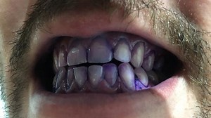 How to use a Disclo Tab