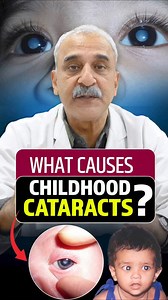 3.7K views · 93 reactions | What Causes Cataracts in Children?...