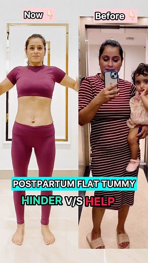 MOMMY- Neetika|DAUGHTERS - Arya N Aarna👭 on Instagram: "In my journey of getting flat belly I never did crunches , push-ups, planks n still got a flat belly n a lot of people think we can’t get flat belly if we don’t do crunches , push-ups & planks but very less know they are biggest hinder for postpartum bodies . Always avoid exercises which put direct pressure on your abs muscles & for reference I have shown you a normal tummy picture & a diastasis recti tummy picture in the end of video & al