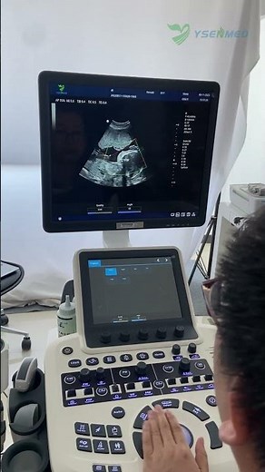 Fetus in 4D mode with YSENMED color doppler ultrasound system YSB-S7.