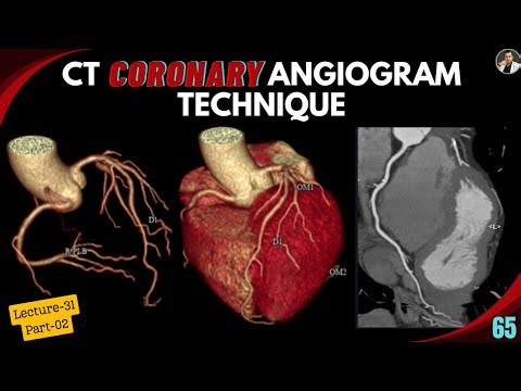 CT Coronary Angiogram Technique - Part-02 | Protocols | Contrast Volume and Flow | Post Processing |