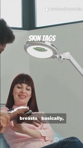 Skin tags explained under 1mins