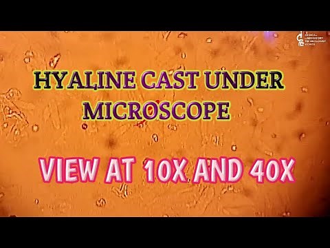 Hyaline cast under microscope.urine cast under microscope.Best and Clear view at 10X and 40X.