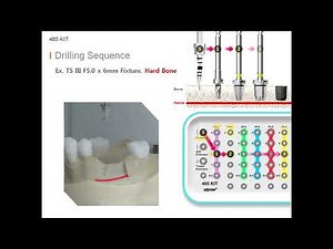 485 KIT Drilling Sequence