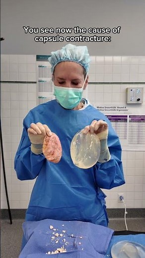 Why does Capsular Contracture Feel Hard? 🤔