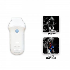 [Hot Item] Konted C10CW Color Doppler Wireless Handheld Echo Scanner WiFi Ultrasound for Advanced Cardiac Imaging