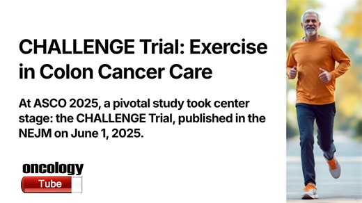 CHALLENGE Trial at ASCO 2025: Exercise Extends Life for Colon Cancer Survivors