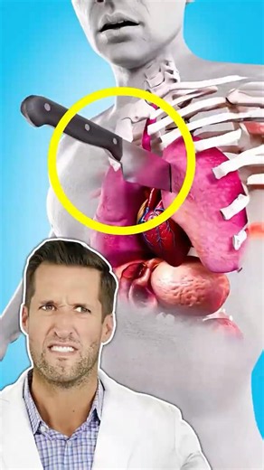 What To Do If You Puncture A Lung 🤔 ER Doctor Reacts