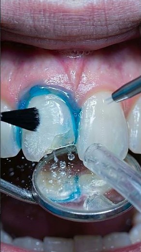 This Broken Tooth Was Fixed Instantly 😳 | Satisfying Repair #satisfying #asmr
